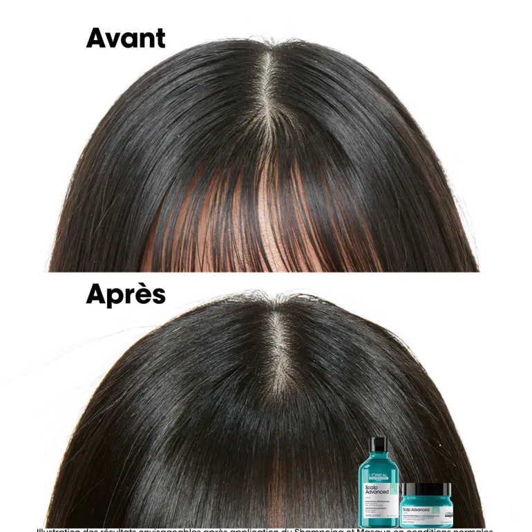 Argile 2-en-1 purifiante anti-gras Scalp Advanced 250ml