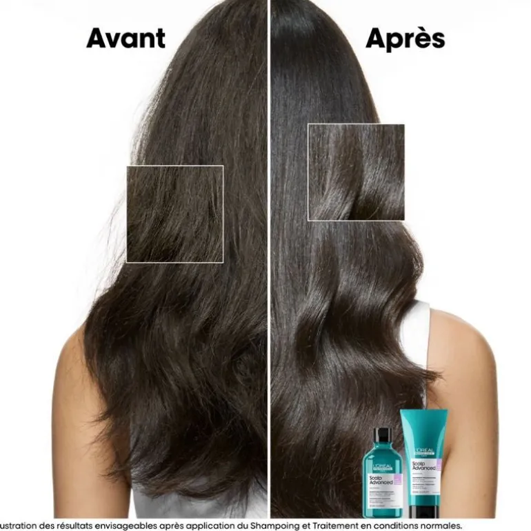 Duo recharge Scalp Advanced + shampooing 300ml