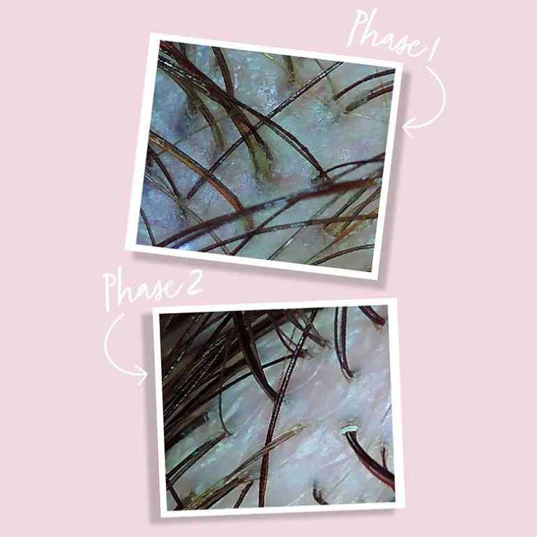 Huile détoxifiante Scalp Detox Oil Treatment