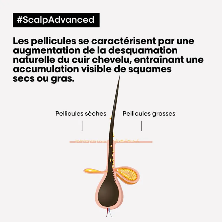 Routine anti-pellicules grasses Scalp Advanced