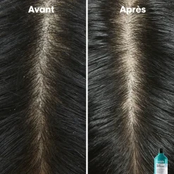 Shampooing dermo-clarifiant anti-pelliculaire Scalp Advanced 1500ml