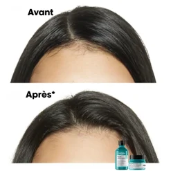 Shampooing dermo-purifiant anti-gras Scalp Advanced 300ml