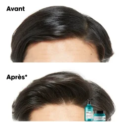 Shampooing dermo-purifiant anti-gras Scalp Advanced 500ml