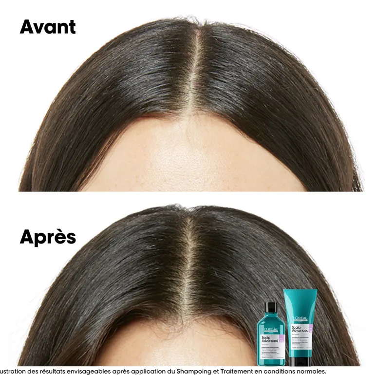 Shampooing dermo-régulateur anti-inconfort Scalp Advanced 300ml