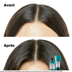 Shampooing dermo-régulateur anti-inconfort Scalp Advanced 500ml