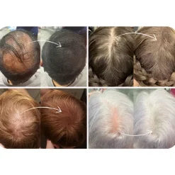 Fibres densifiantes pour cheveux noir